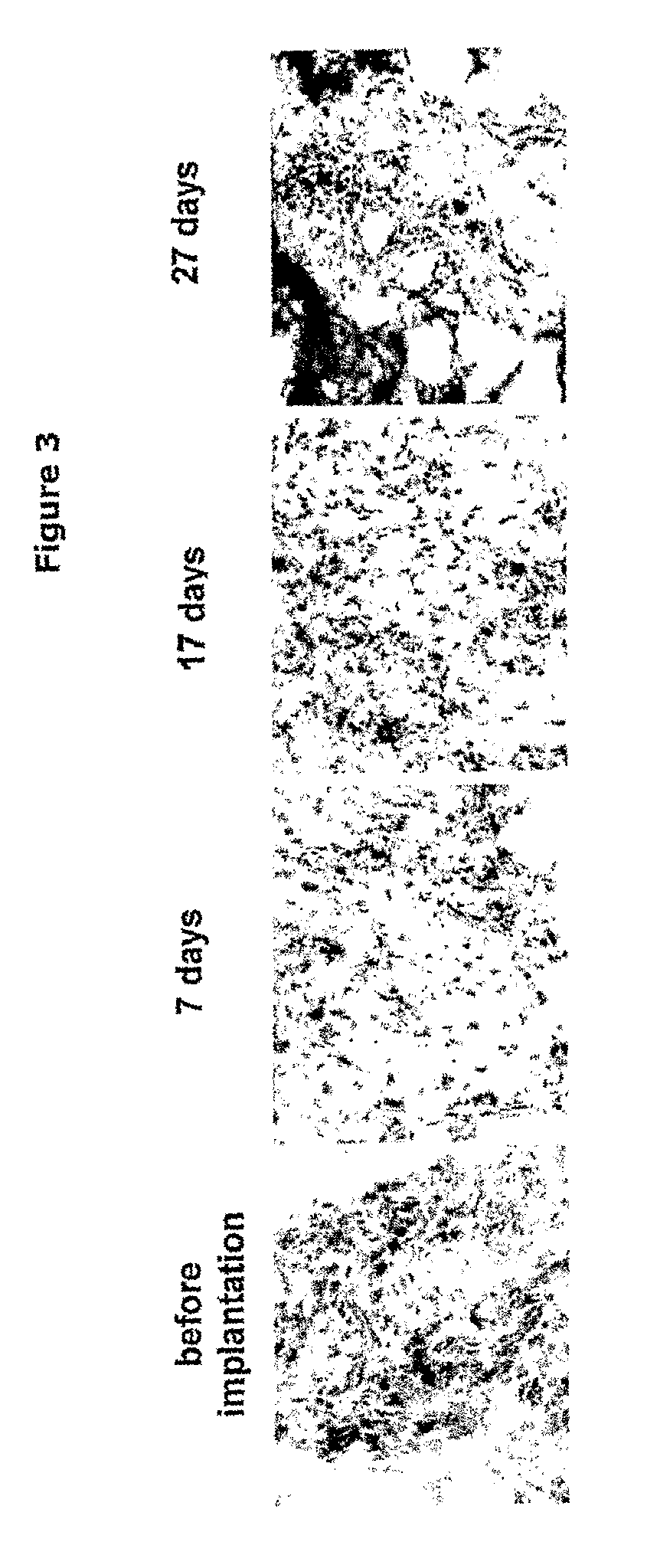 Non-Human mammalian Arthritis Model Featuring Human Antibodies Against Citrul-Linated Proteins