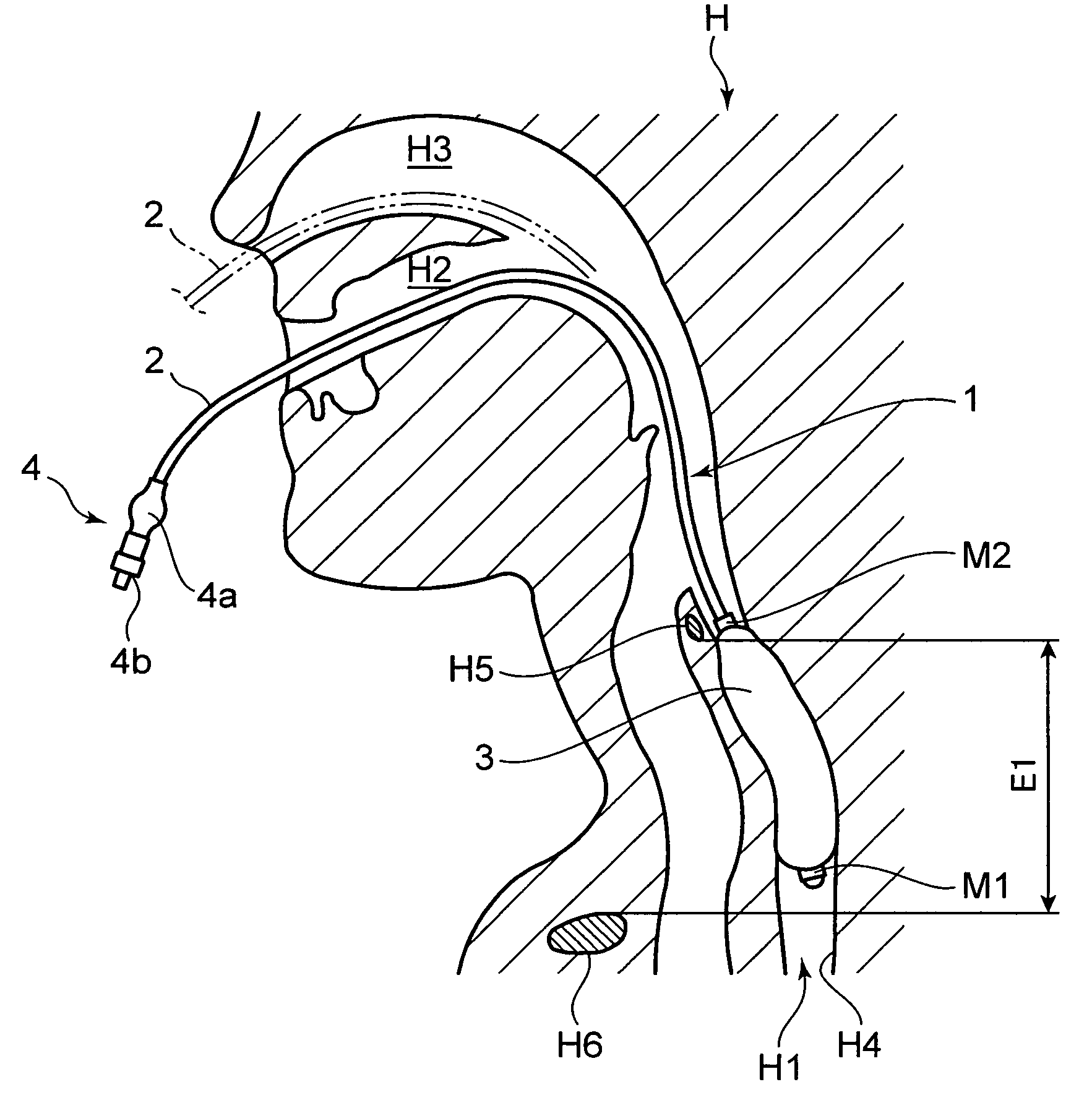 Brain Cooling Device and Brain Cooling System Comprising the Device