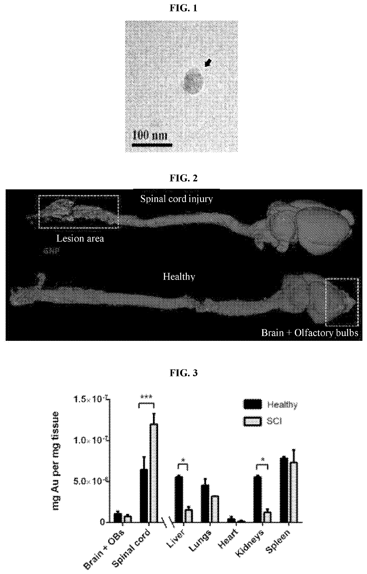 Vesicles comprising a pten inhibitor and uses of same