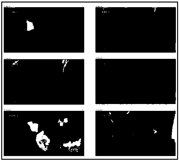 A caption extraction method based on image segmentation and dynamic threshold