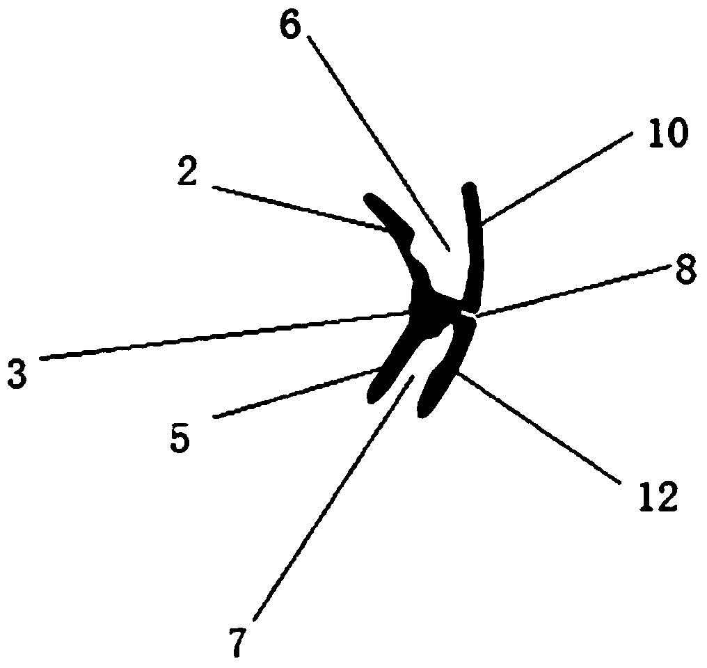 A type III personalized functional appliance