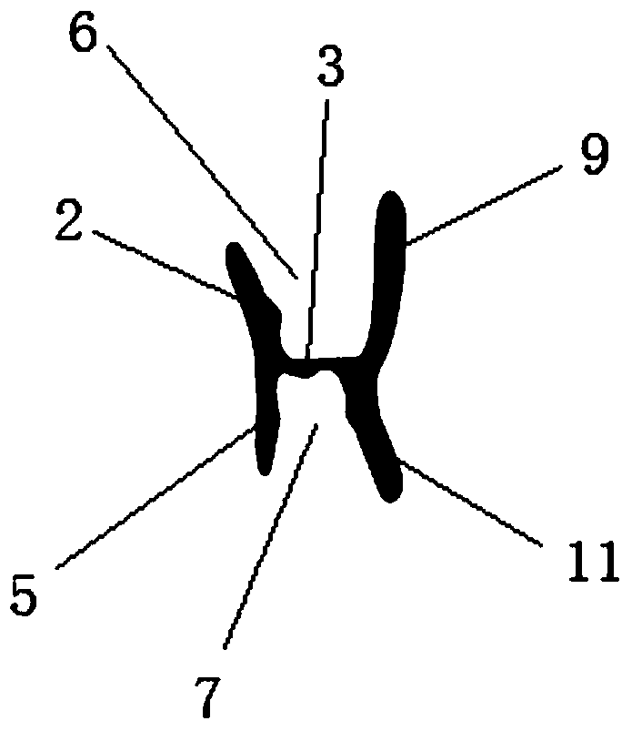 A type III personalized functional appliance