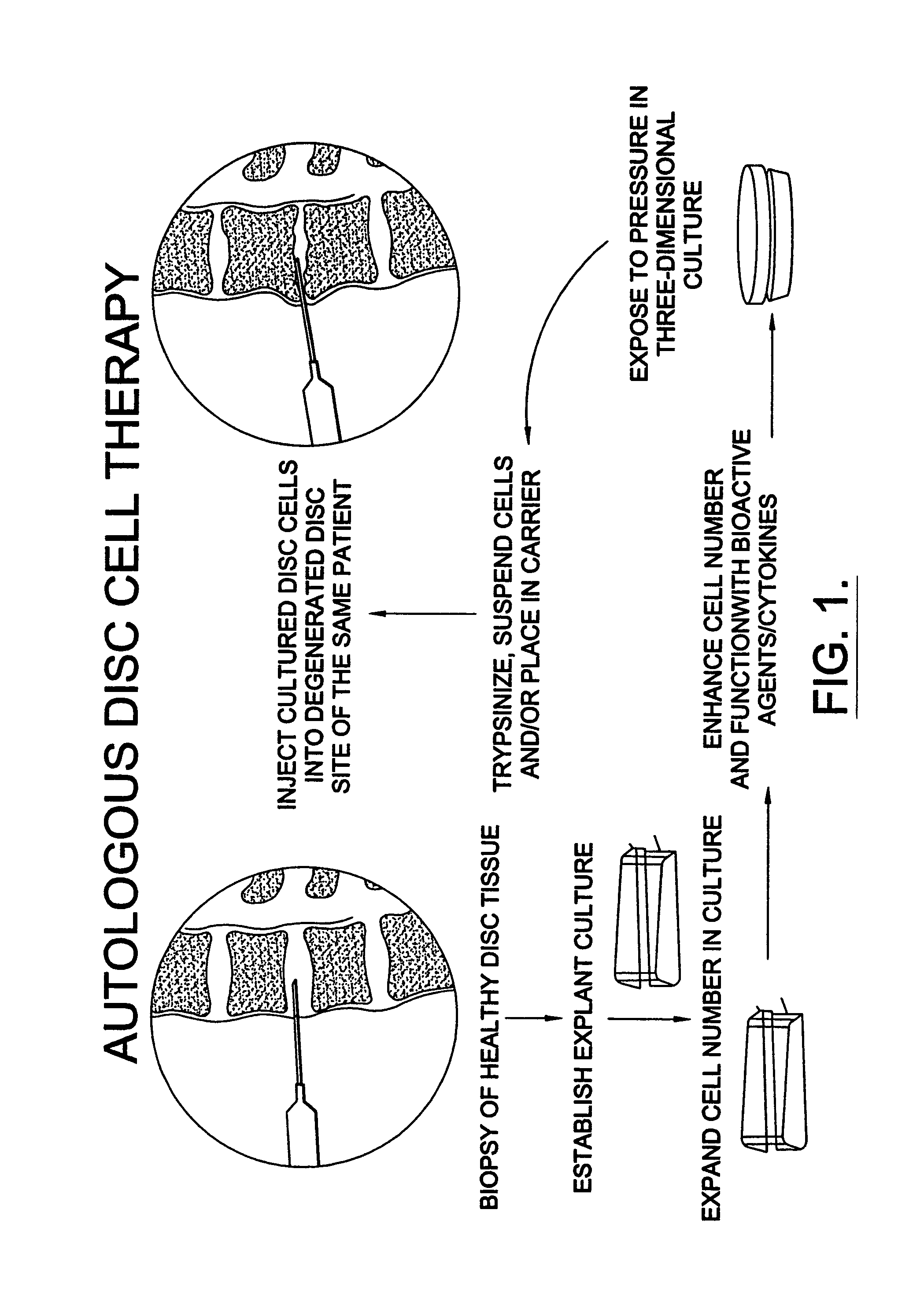 Method for using human intervertebral disc cells