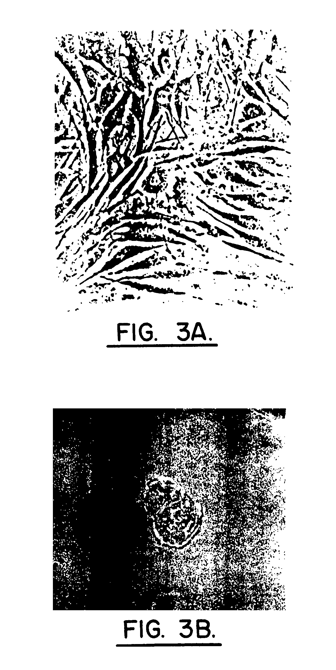 Method for using human intervertebral disc cells