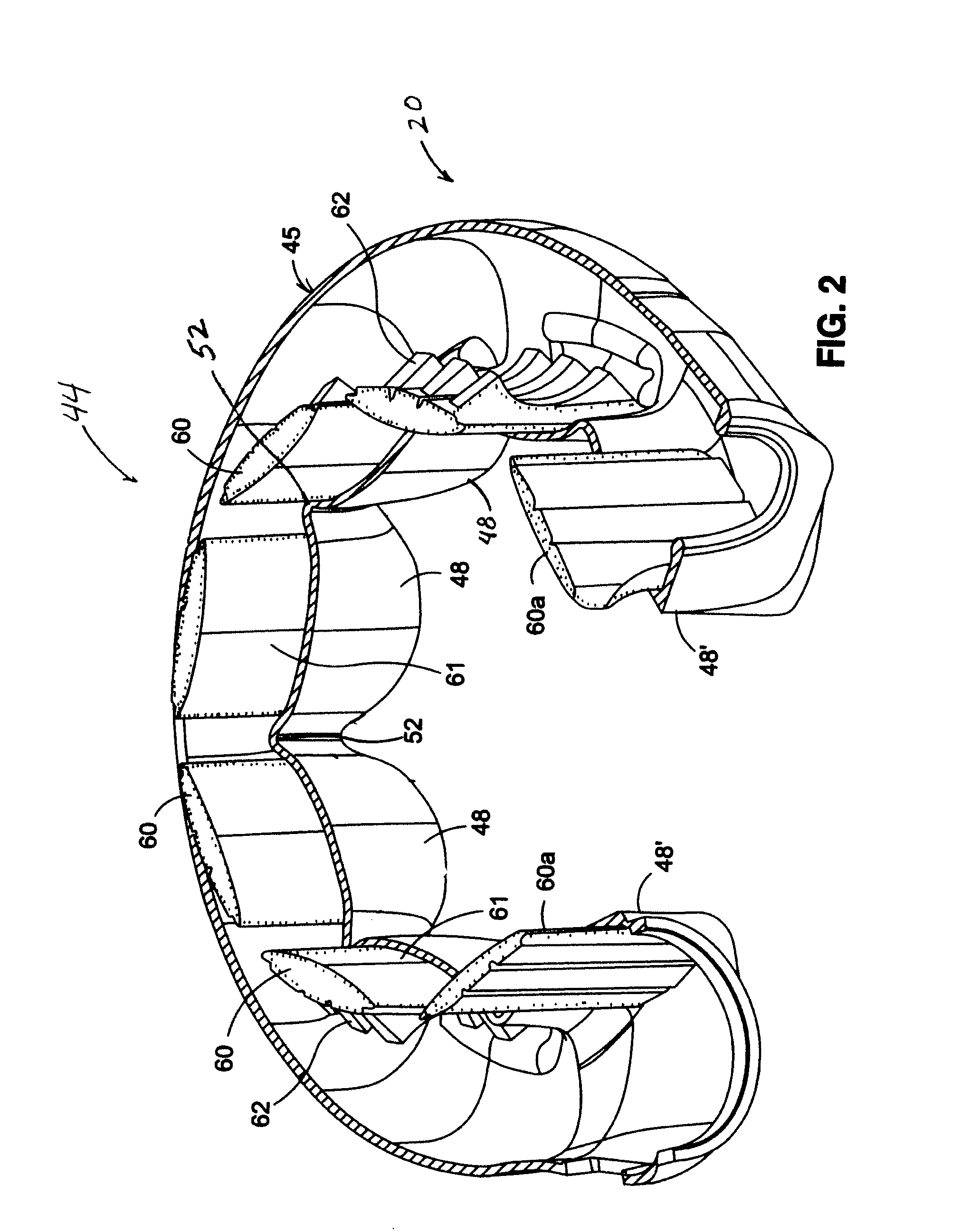 Mechanical gastric band with cushions