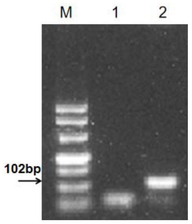 A primer pair for detecting watermelon bacterial fruit spot and its application