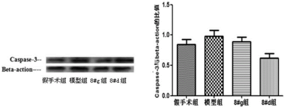 Application of 3,4-dihydroxybenzaldehyde in preparation of medicine for treating or/and preventing cerebral ischemia-reperfusion injury