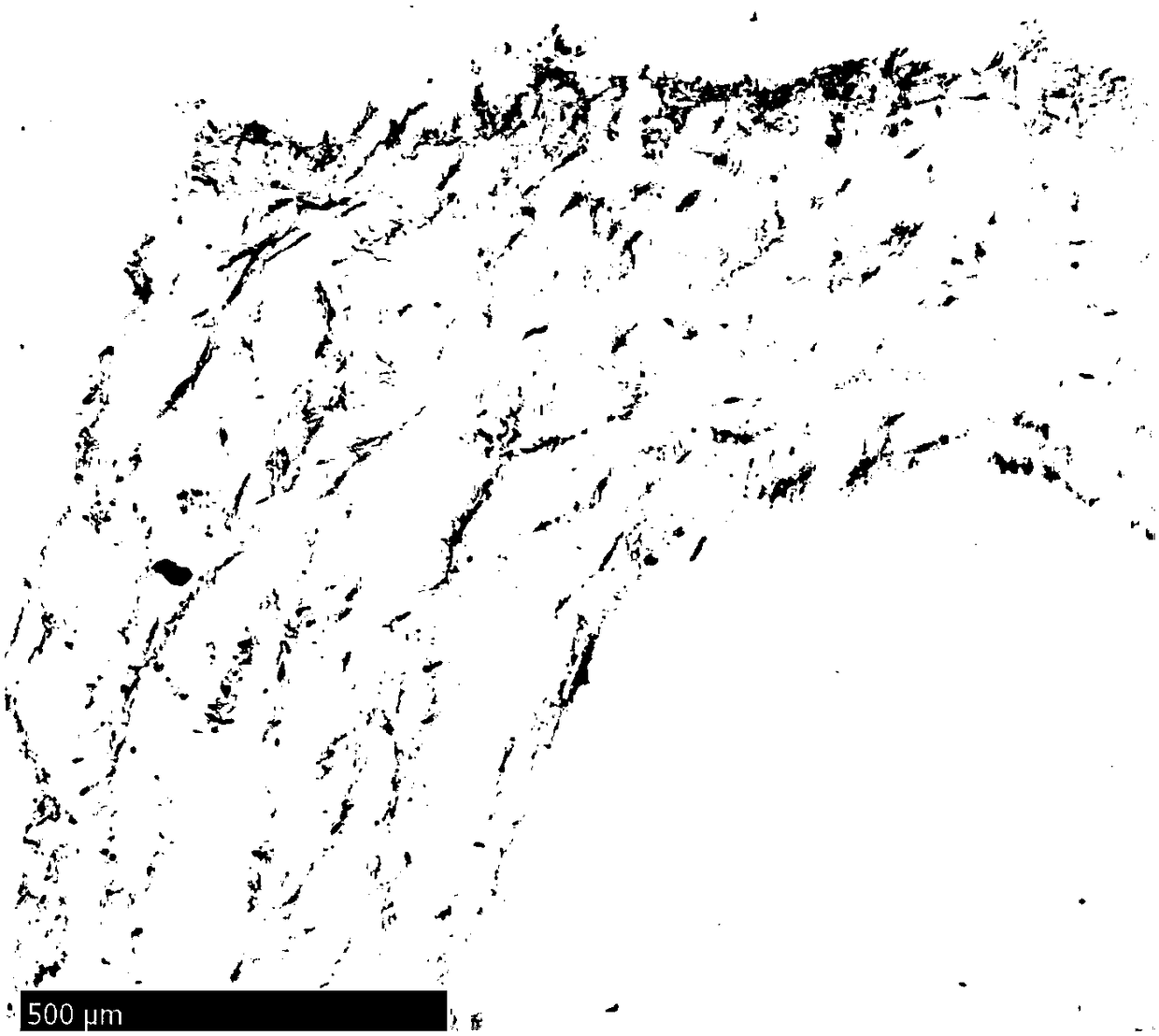 Preparation and cryopreservation method and application of human placental chorionic tissues