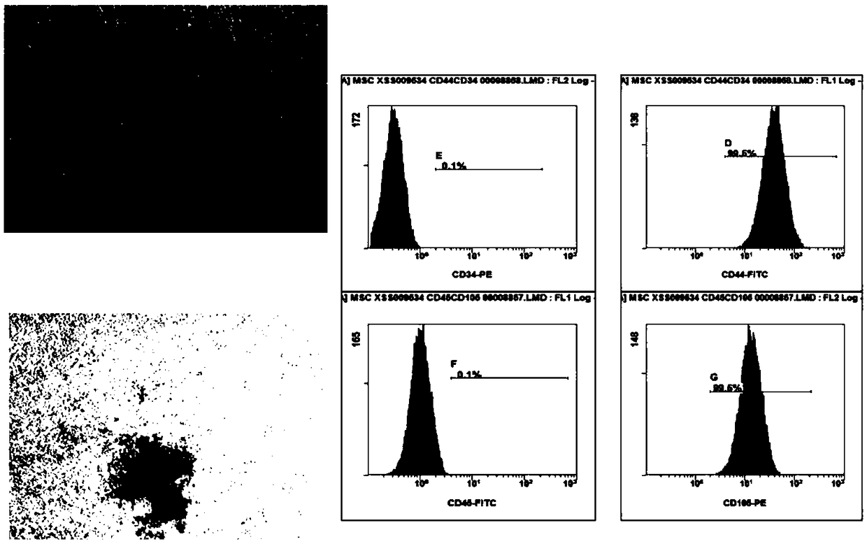 Preparation and cryopreservation method and application of human placental chorionic tissues