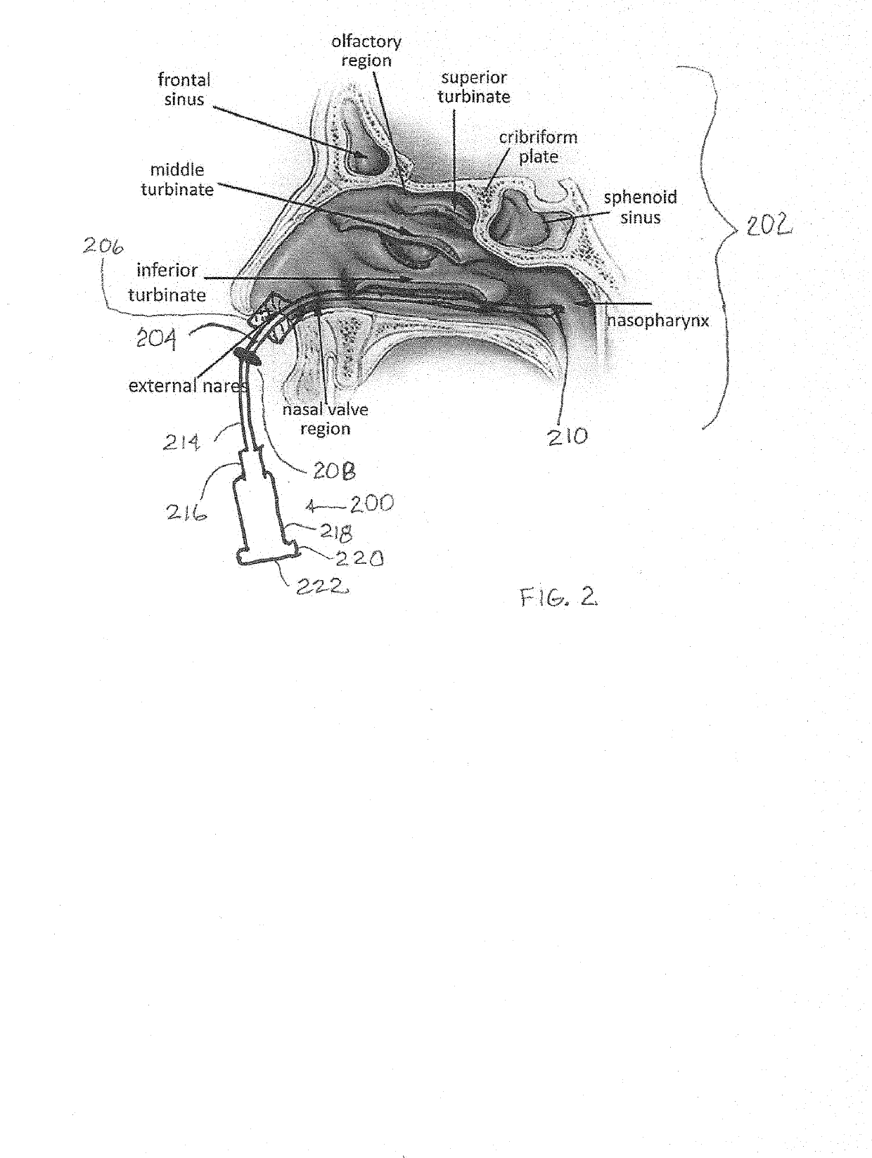 Nasal smoke evacuator