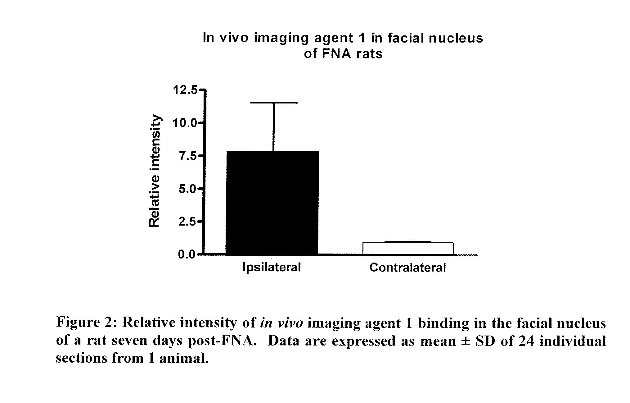 Imaging neuroinflammation