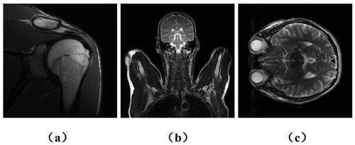 Fast MRI Image Reconstruction Method Based on Tensor Product-Complex Wavelet Compact Frame