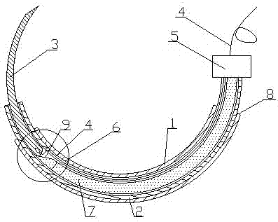 Instrument facilitating suture in laparoscopic surgery