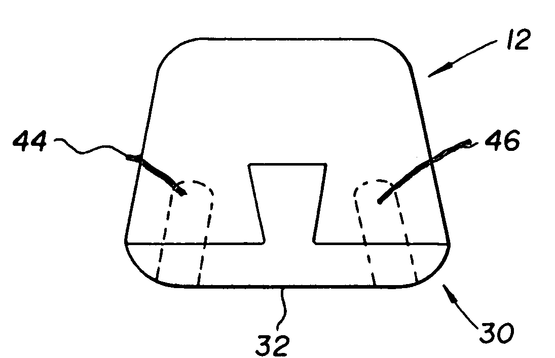 Cortical and cancellous allograft cervical fusion block