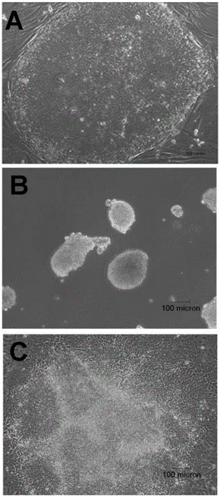 Method for inducing human embryonic stem cells to be differentiated into retinal pigment epitheliums (RPE) in vitro