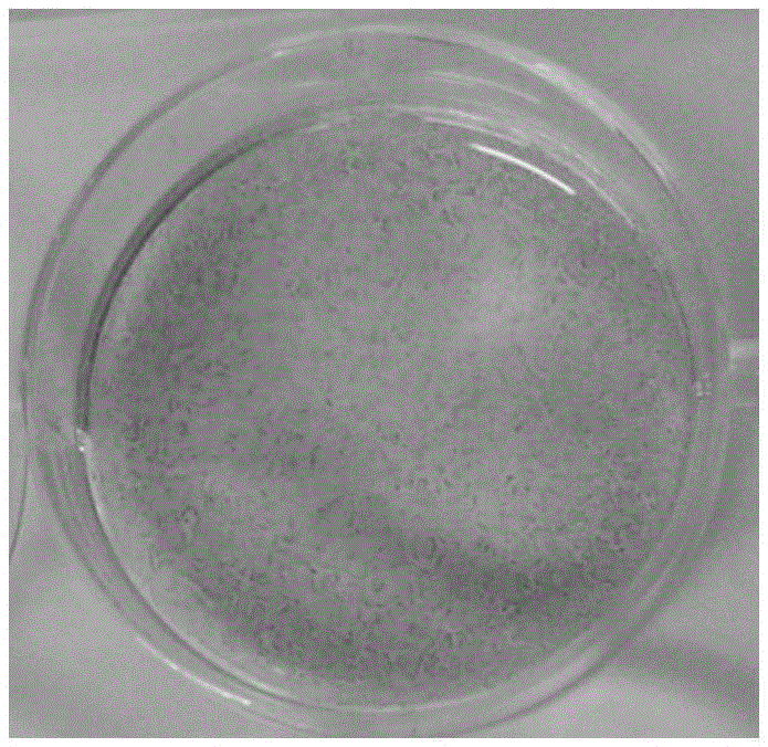 Method for inducing human embryonic stem cells to be differentiated into retinal pigment epitheliums (RPE) in vitro