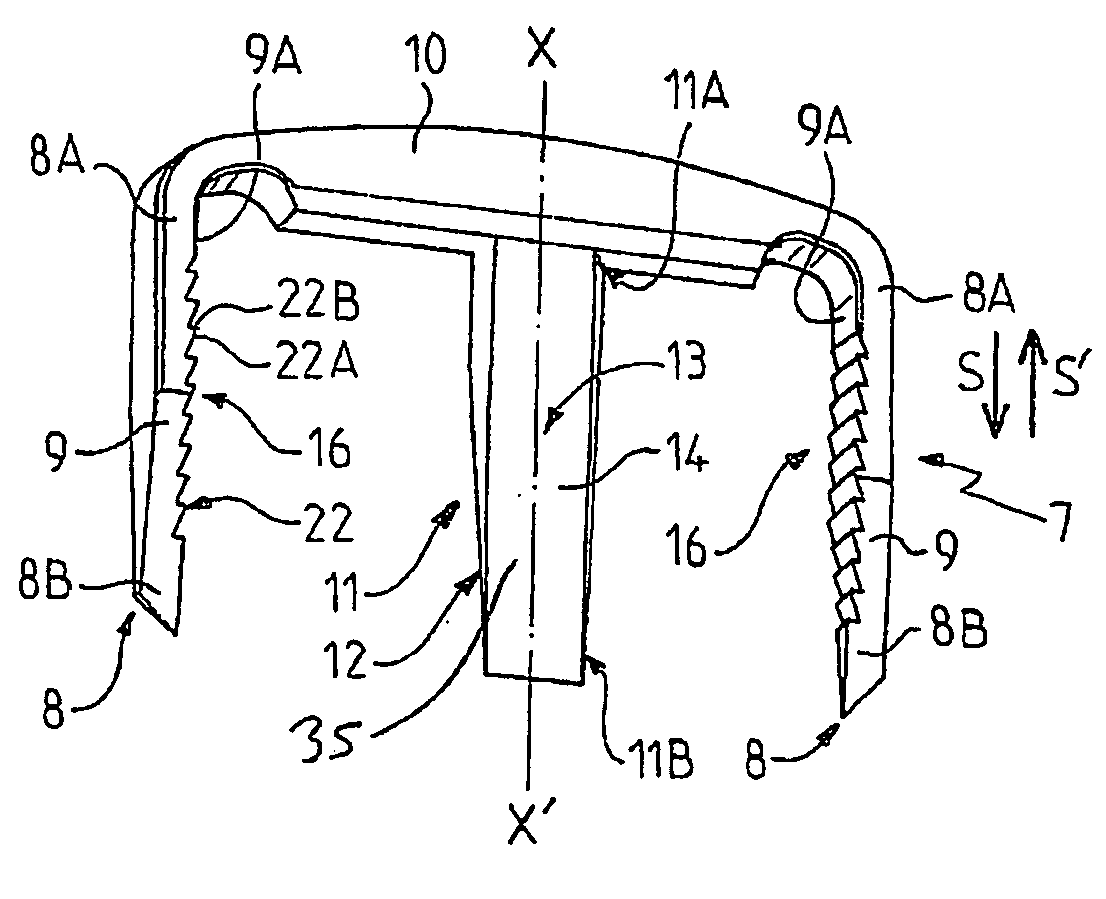 Fixation implant for a bone graft within a joint for the purpose of ensuring arthrodesis of the joint