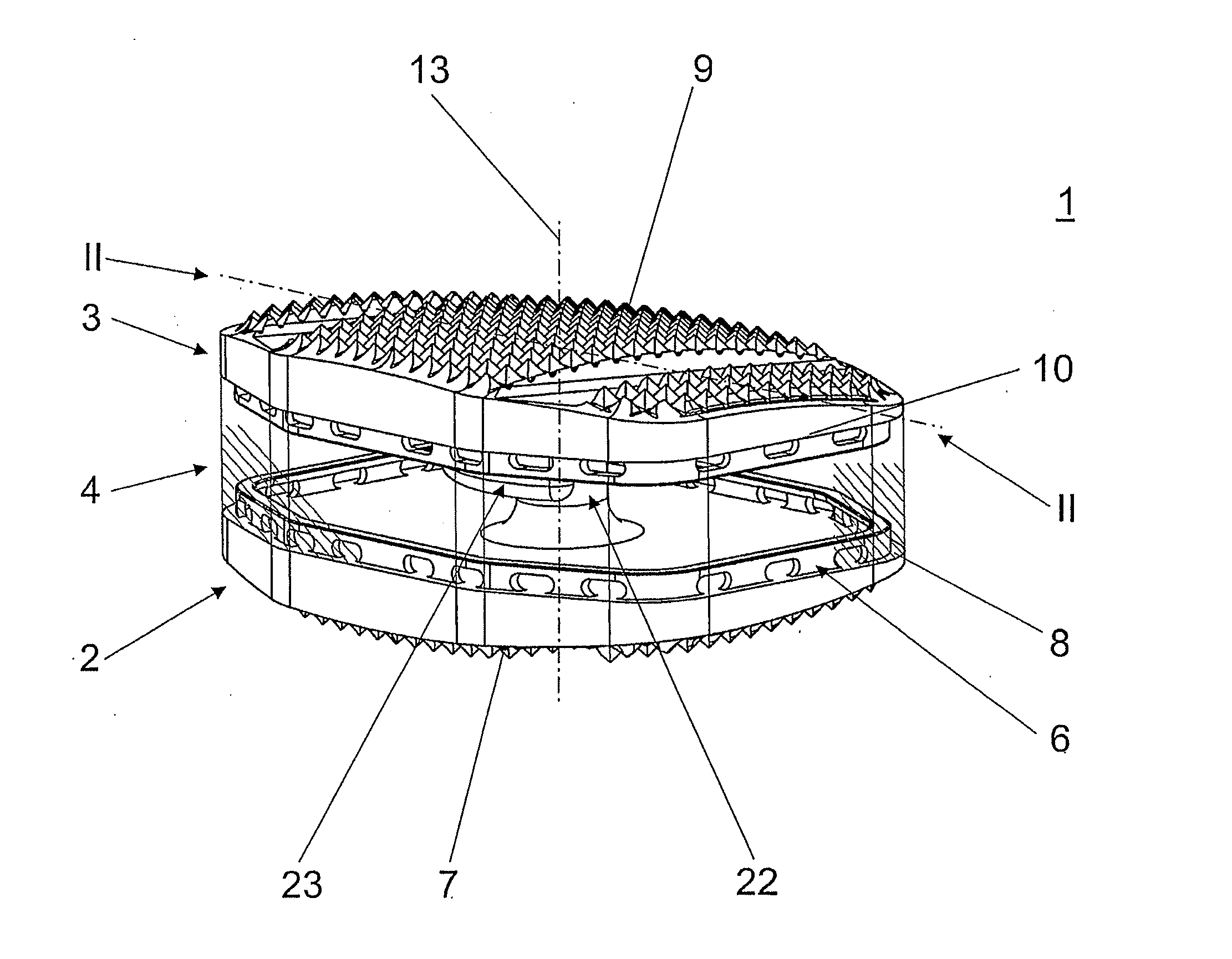 Total disc replacement device