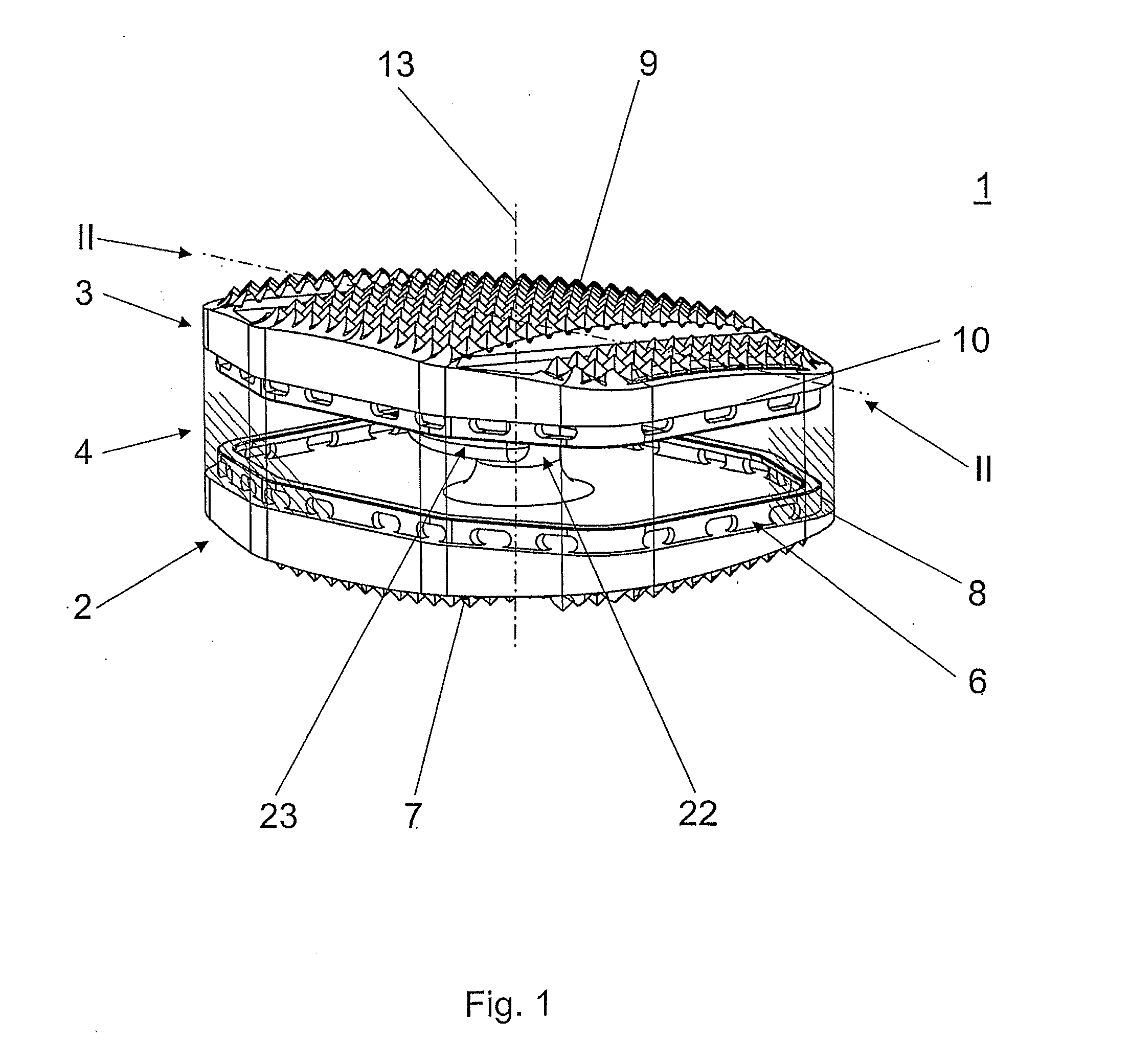 Total disc replacement device