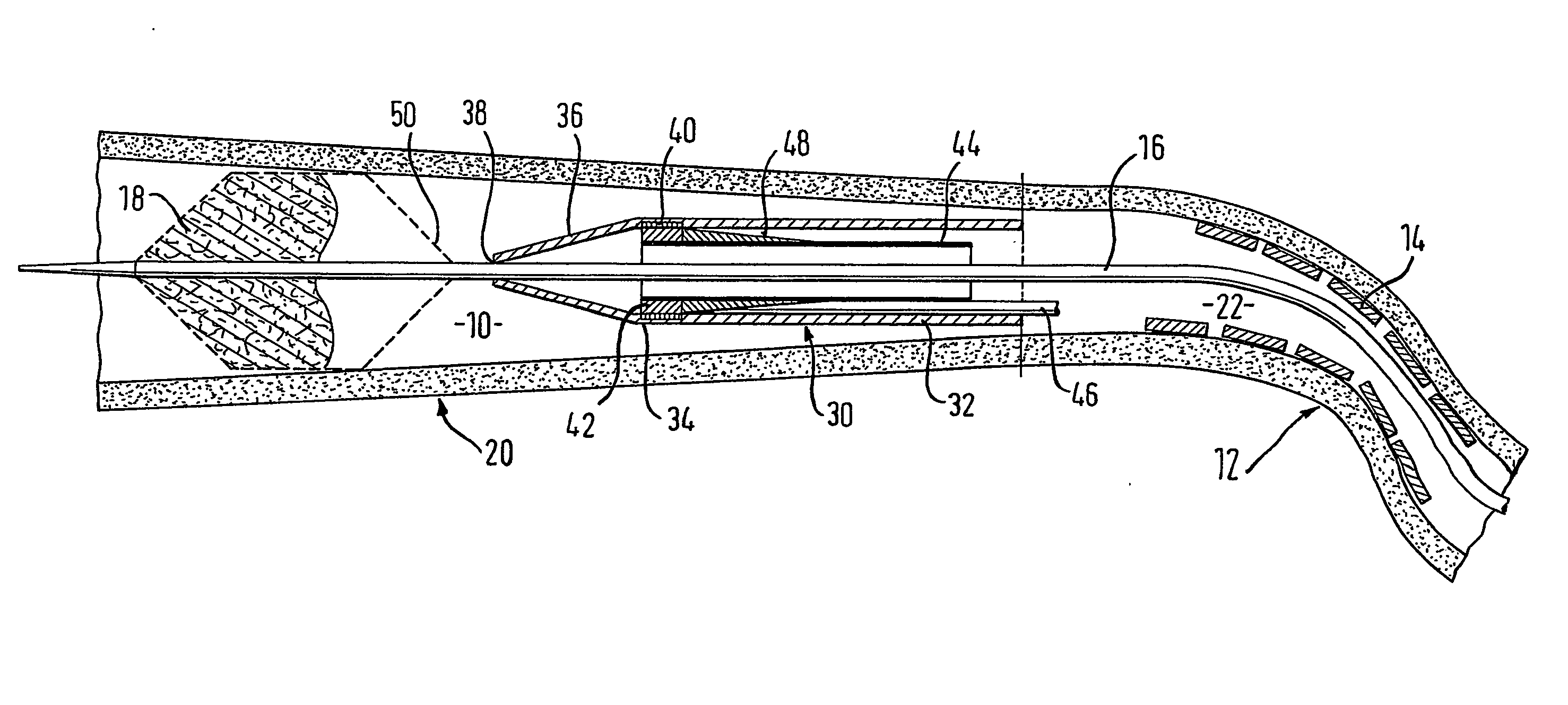 Retrieval catheter