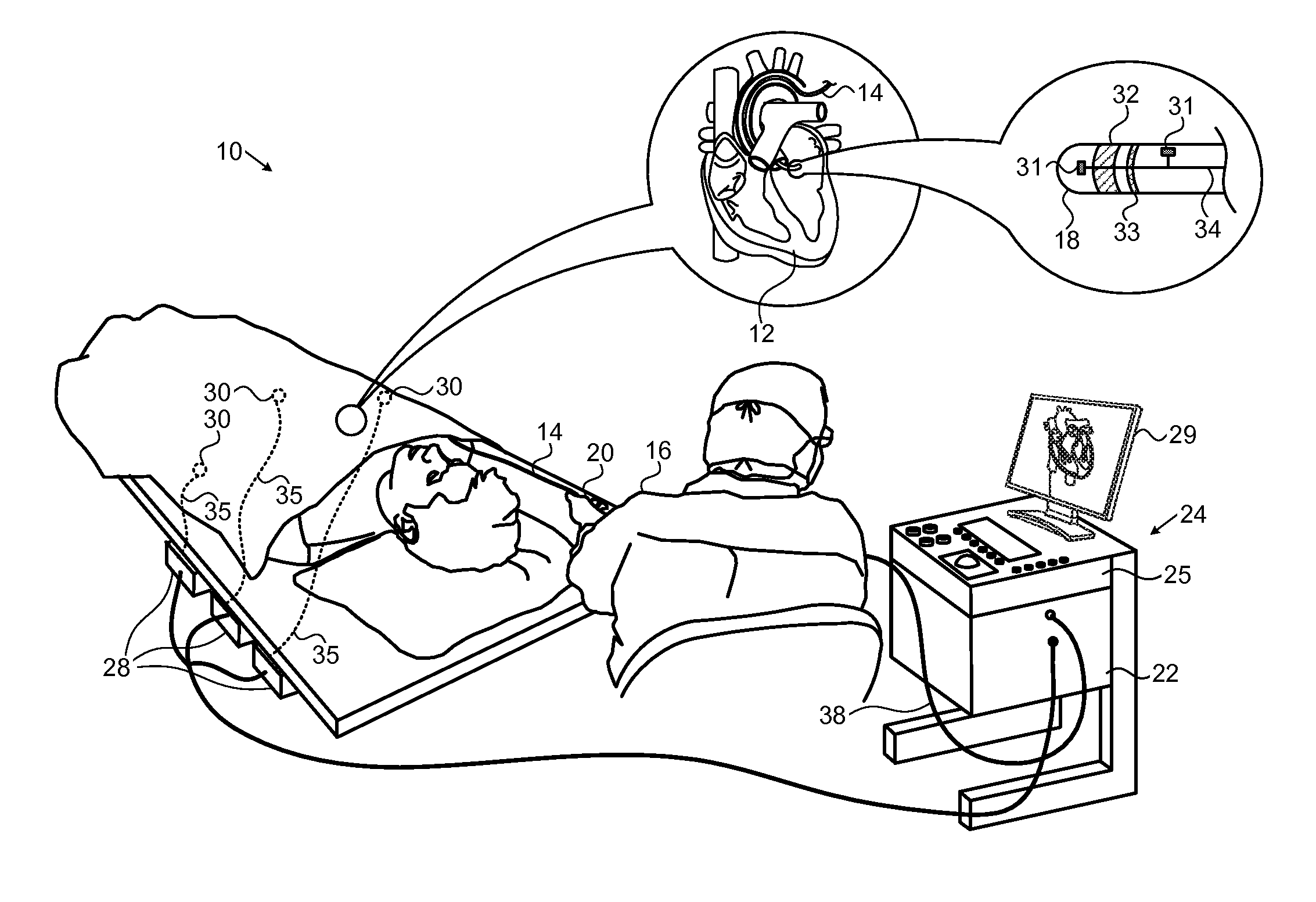 Dynamic feature rich anatomical reconstruction from a point cloud