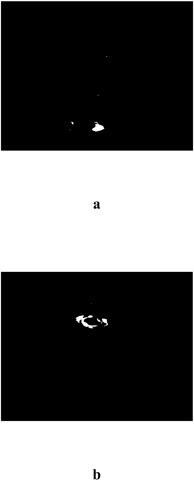 Azithromycin ophthalmic in-situ gel and preparation method thereof