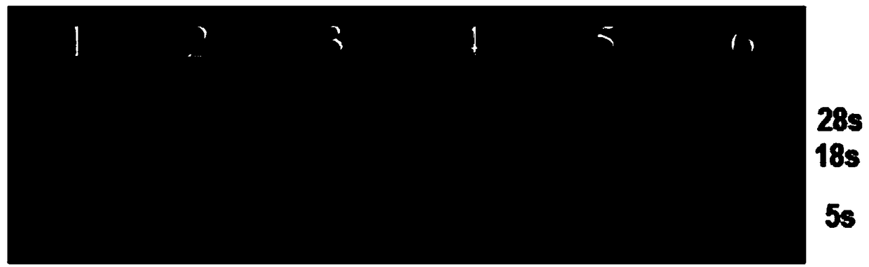 Application of MS-275 in preparation of drug for promoting insulin secretion