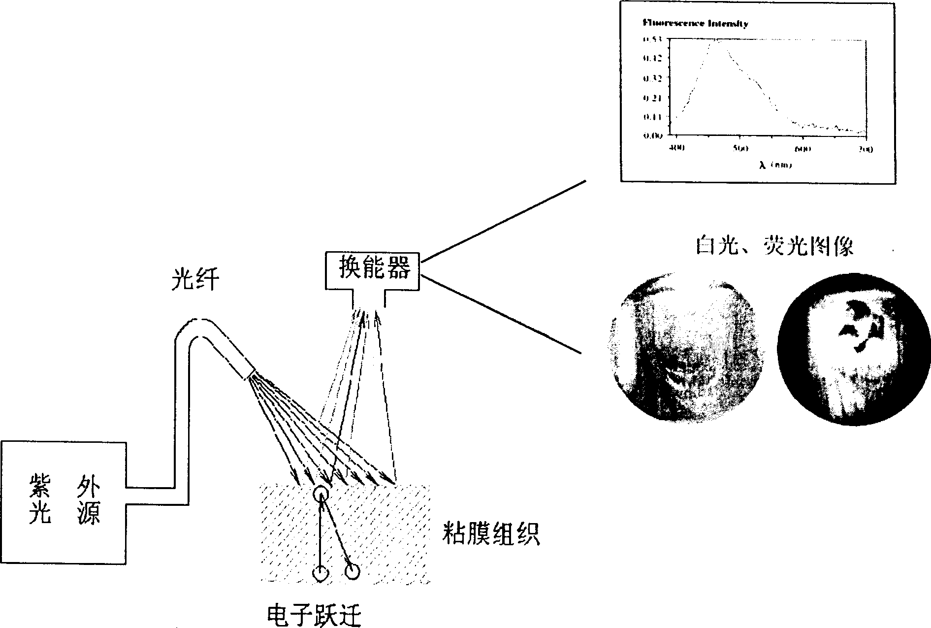 Device using endoscope to diagnose precancer affection