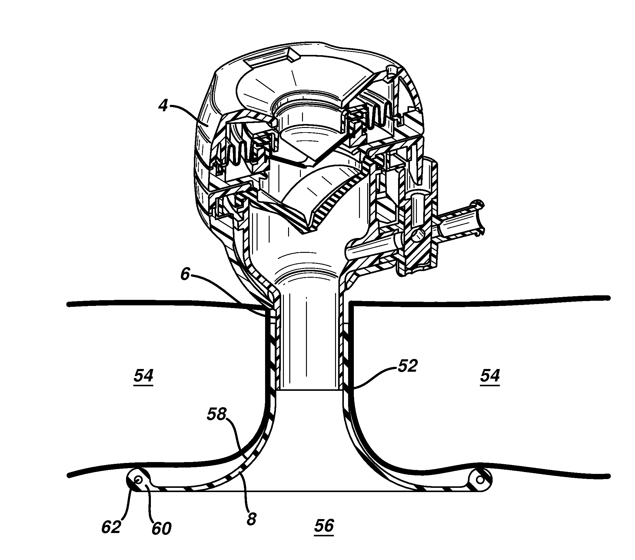 Retractor with flexible sleeve