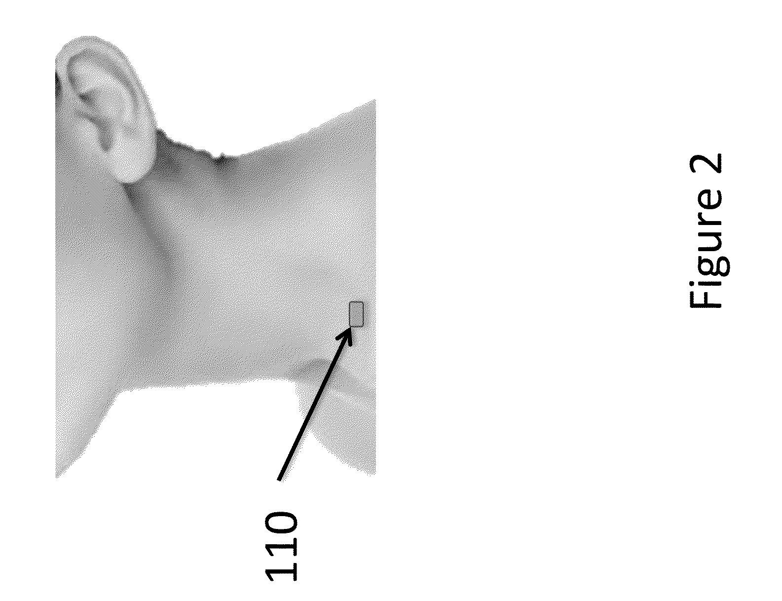 Device and method for interfering with sympathetic chain signaling for attenuating hot flashes, post-traumatic stress disorder, pain and dysautonomia