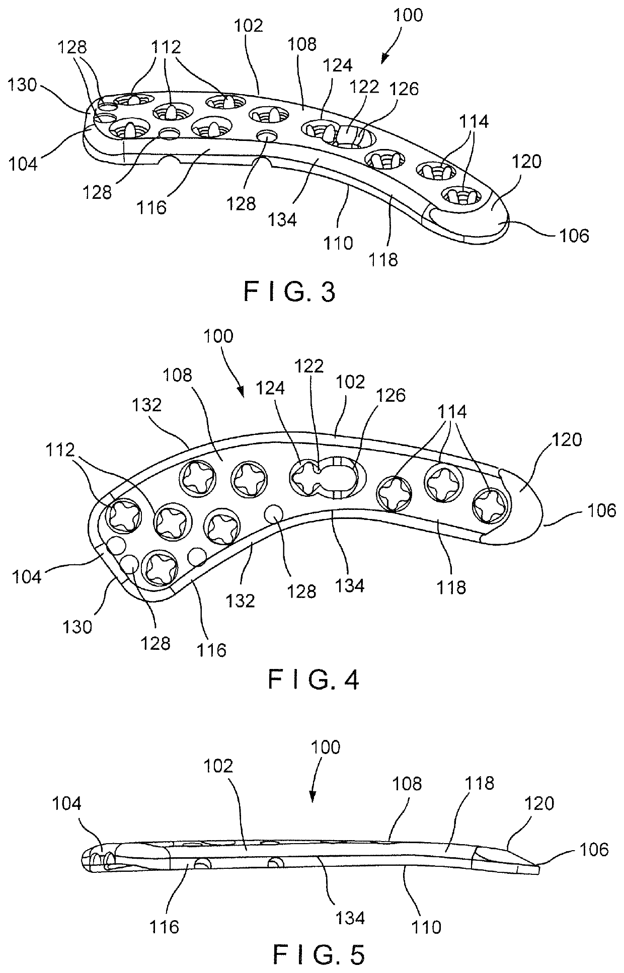 Clavicle segmental plate system