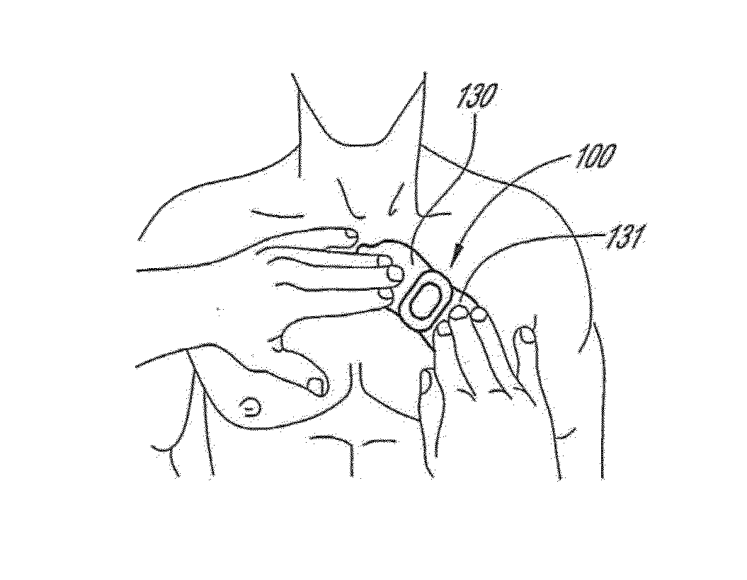 Physiological monitoring device