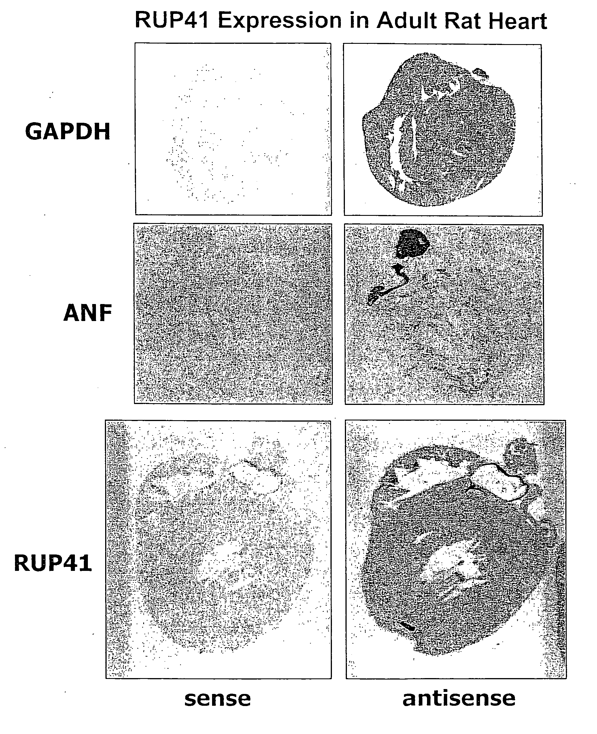 Human G protein-coupled receptor and modulators thereof for the treatment of ischemic heart disease and congestive heart failure