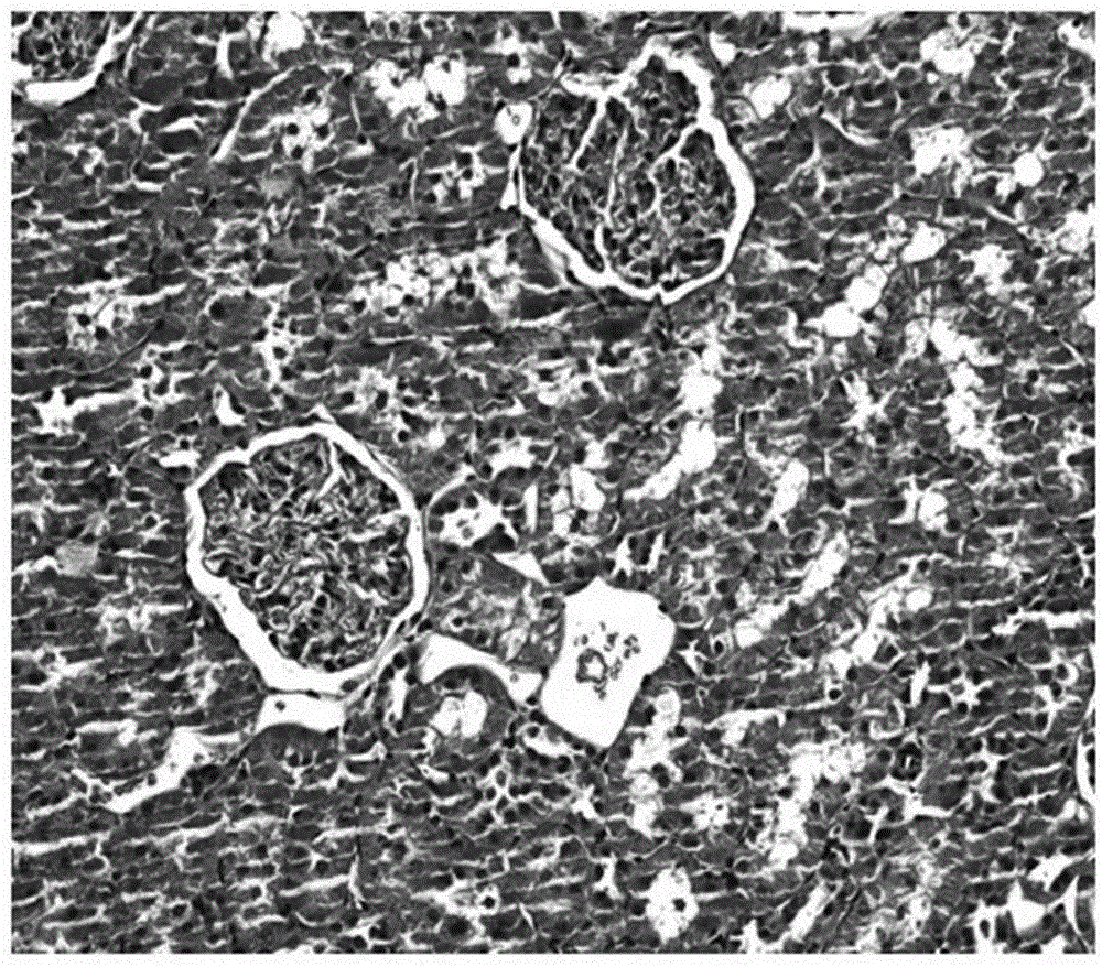 Application of traditional Chinese medicine composition in preparation of medicines for improving lipid metabolism