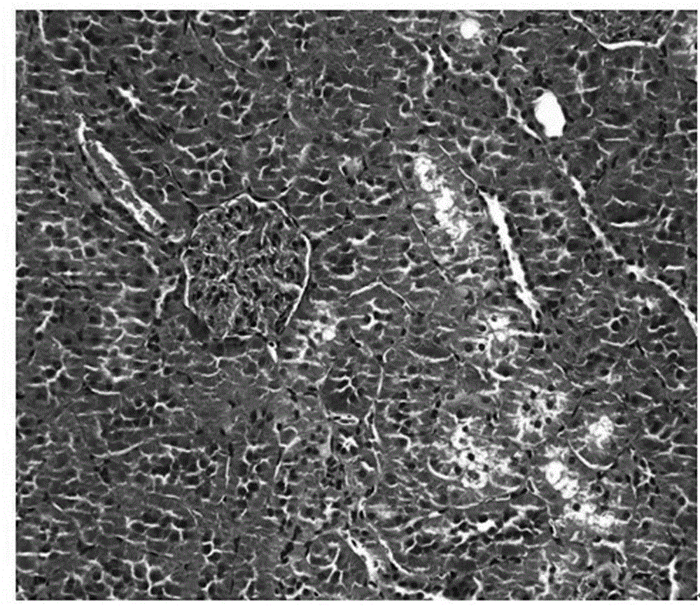 Application of traditional Chinese medicine composition in preparation of medicines for improving lipid metabolism