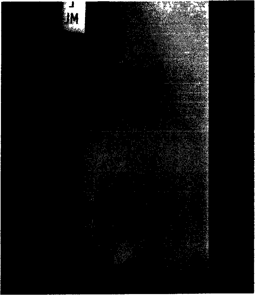 A processing system of unbalanced medical image and processing method thereof