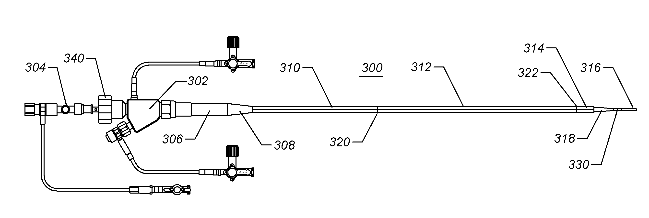 Expandable iliac sheath and method of use