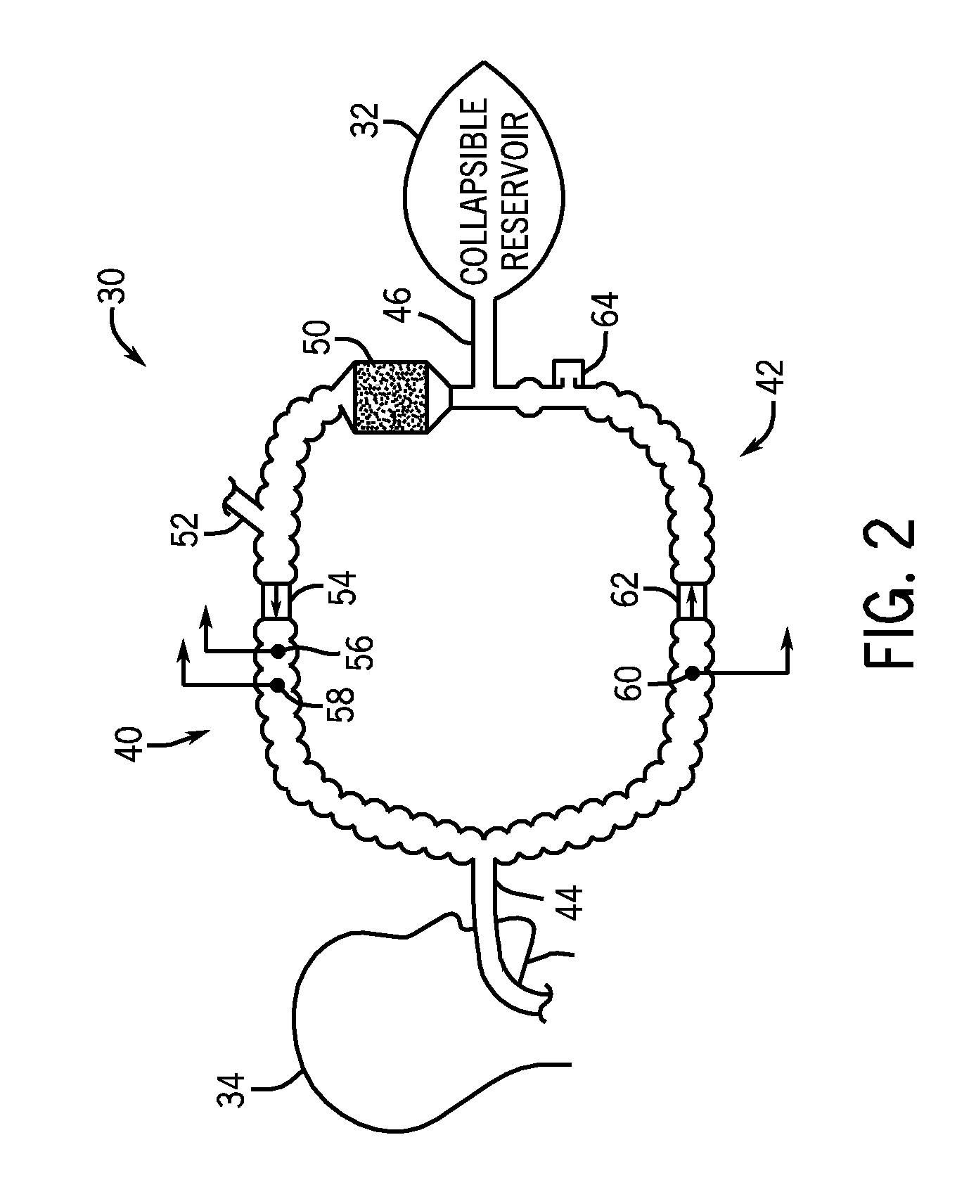 Automatic fresh gas control system