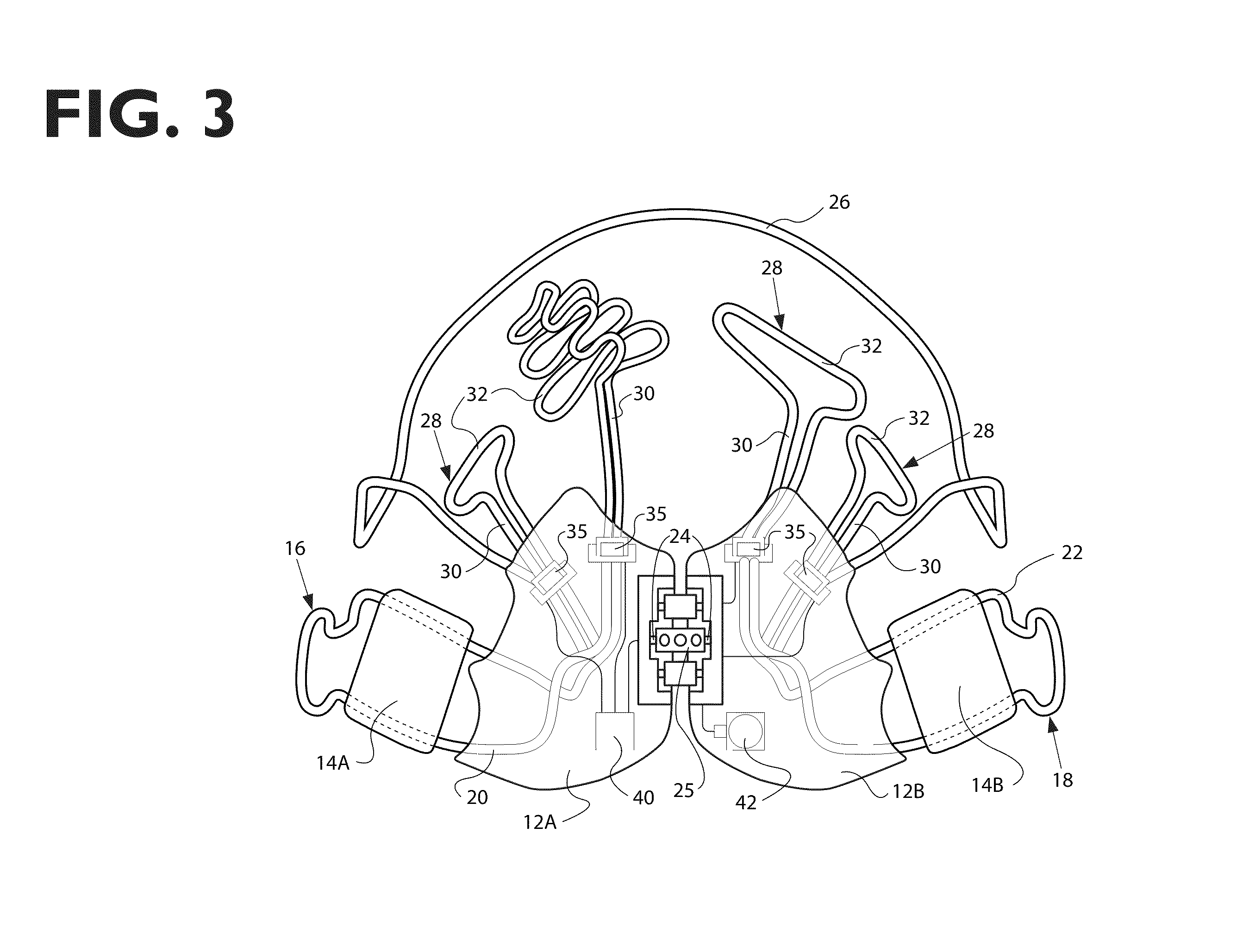 Osteogenetic-orthodontic device, system, and method