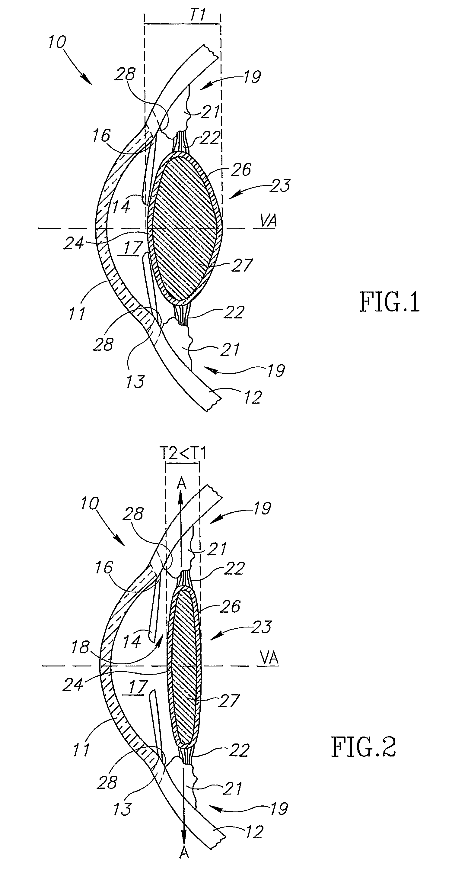 Unitary accommodating intraocular lenses (AIOLs) and discrete base members for use therewith