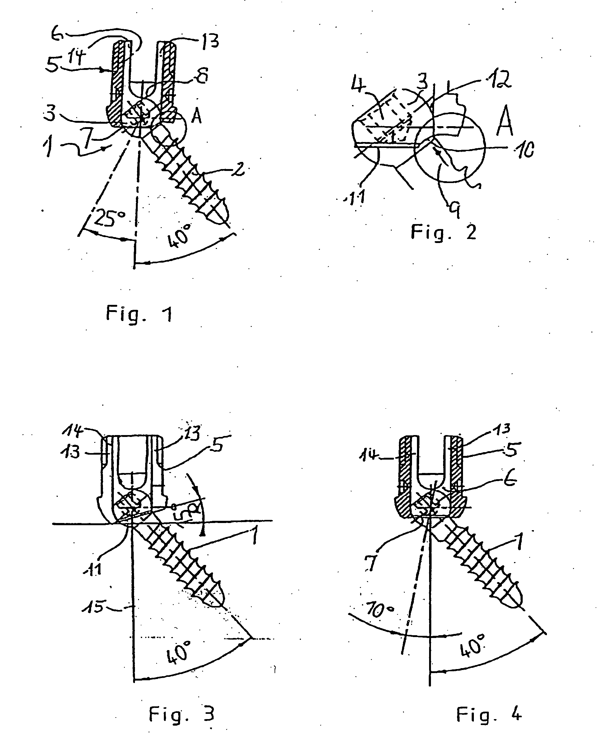 Bone screw