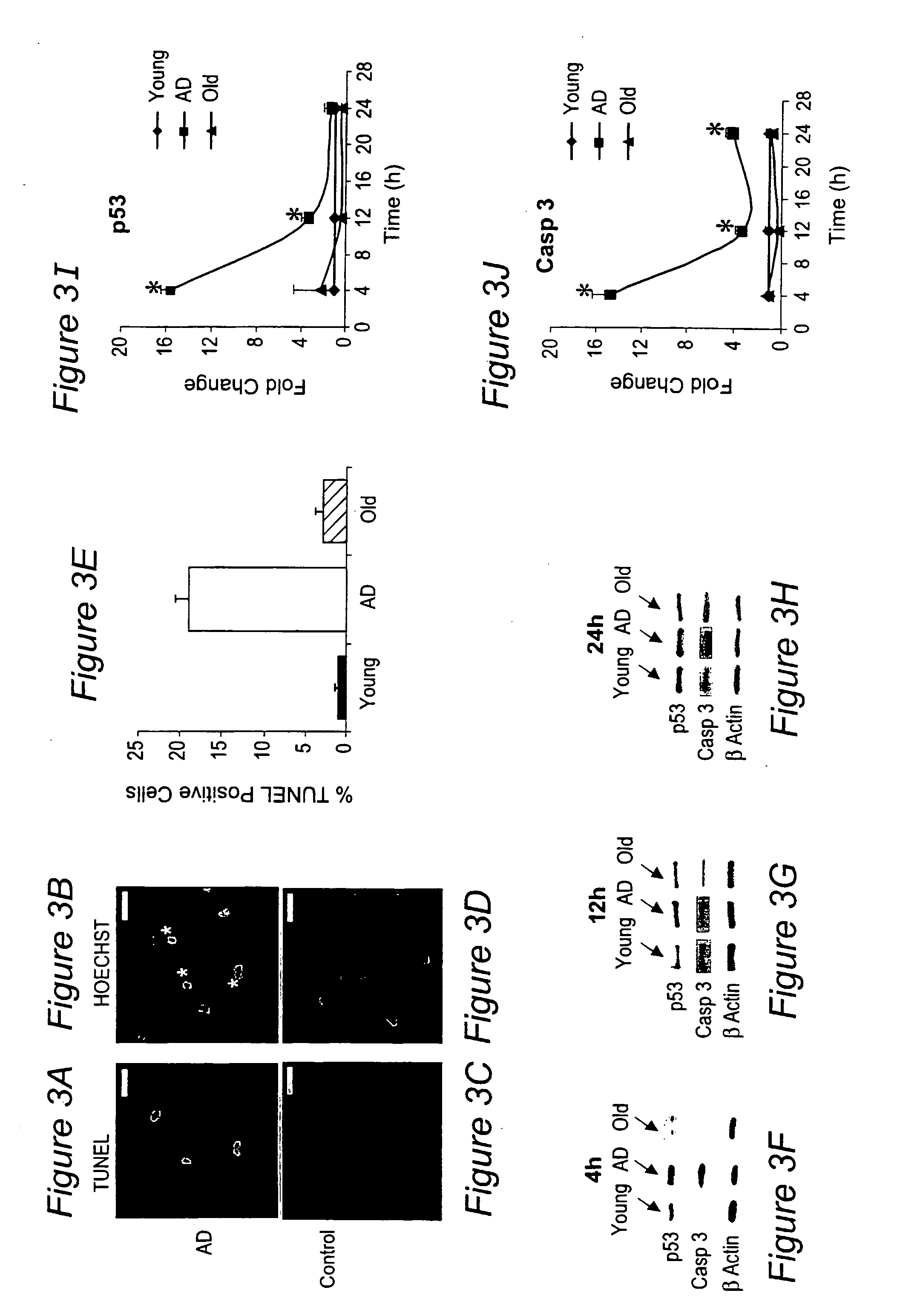 Treatment of vascular dysfunction and alzheimer's disease