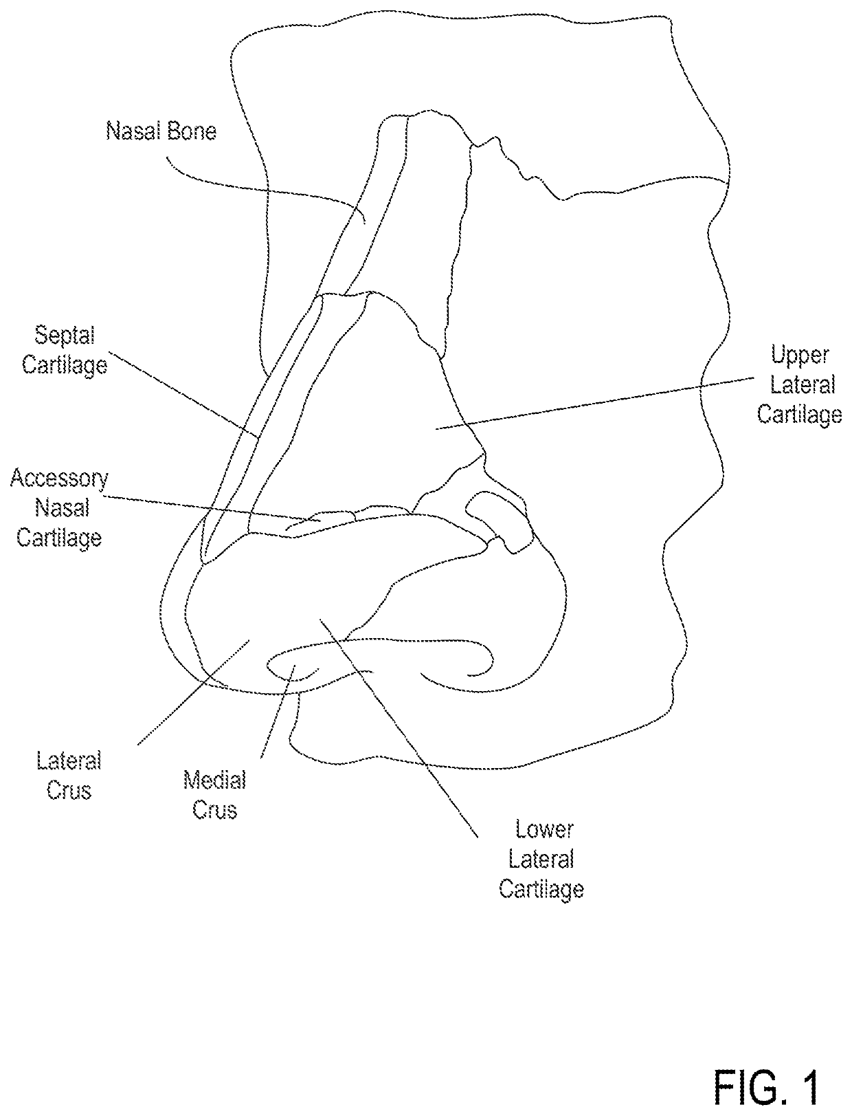 Methods and devices to treat nasal airways