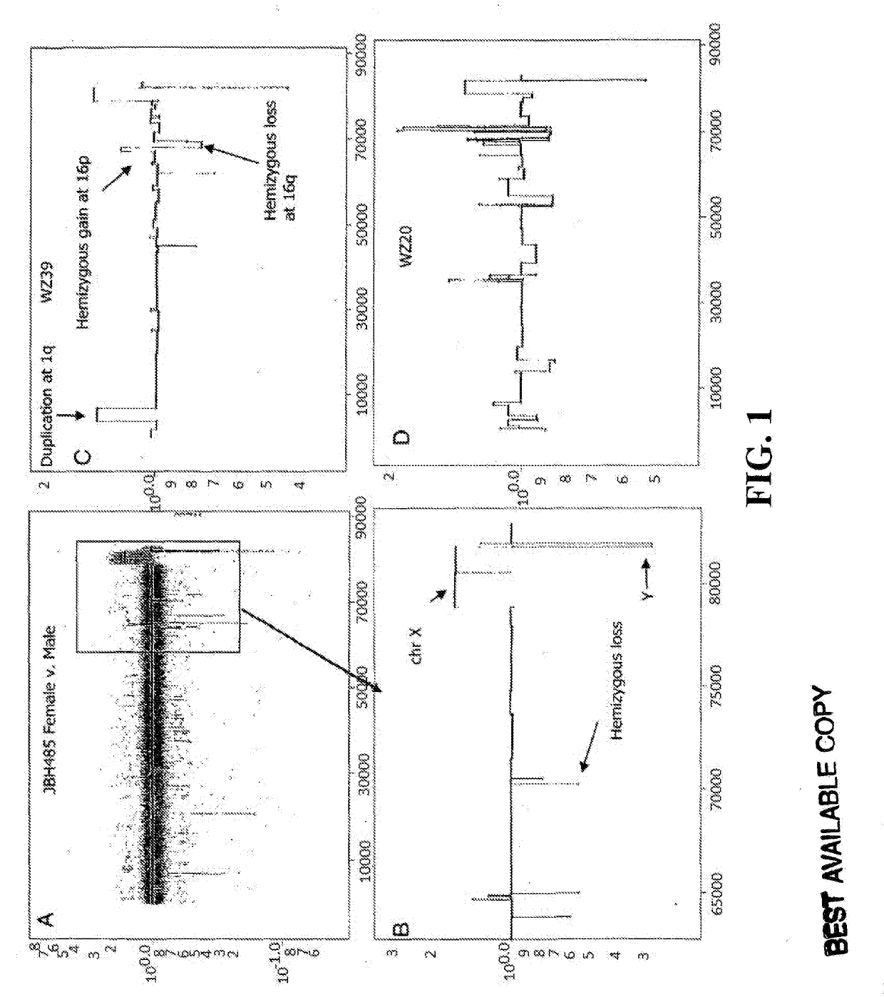 Determining a probabilistic diagnosis of cancer by analysis of genomic copy number variations