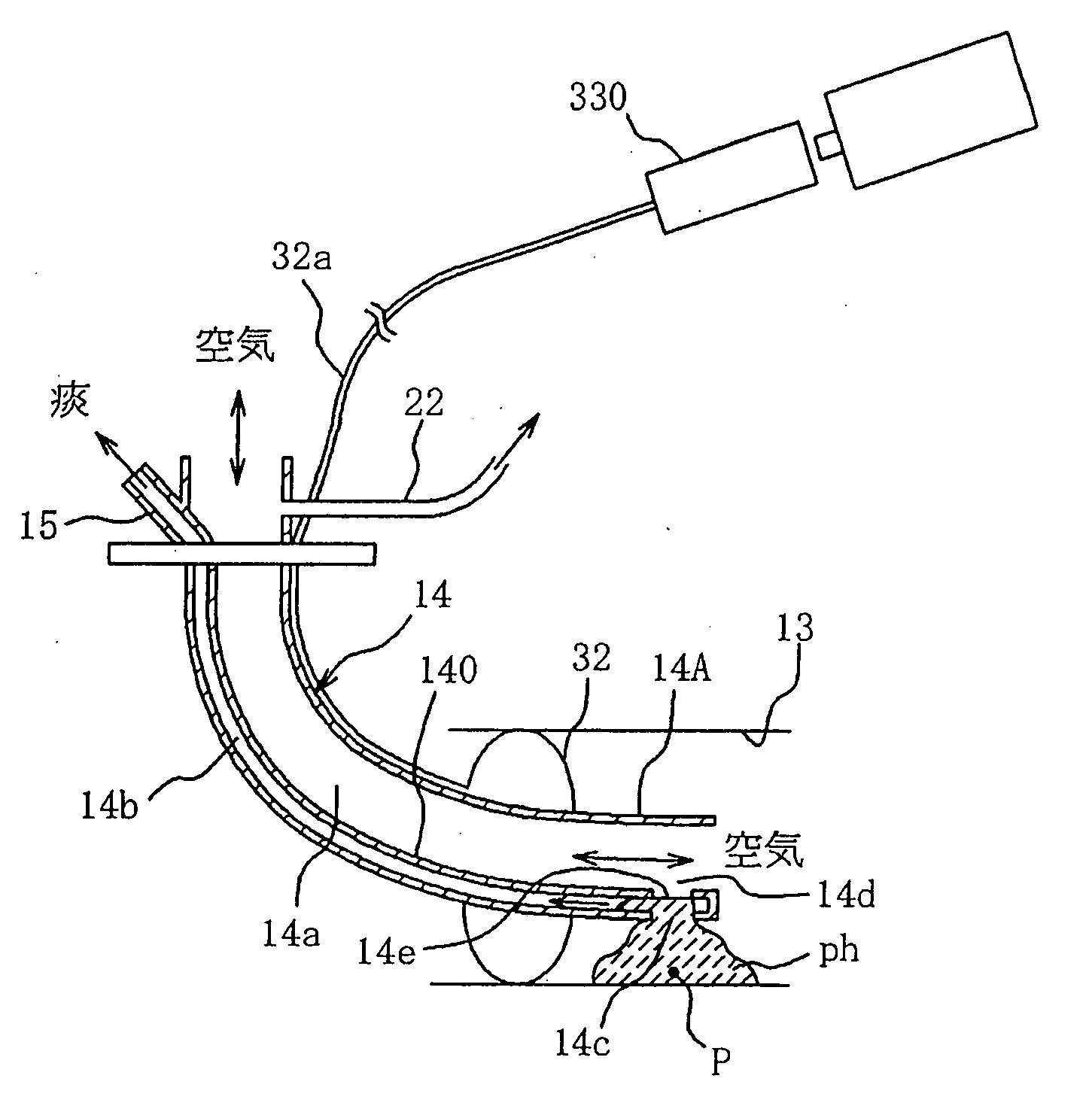 Tracheal Cannula