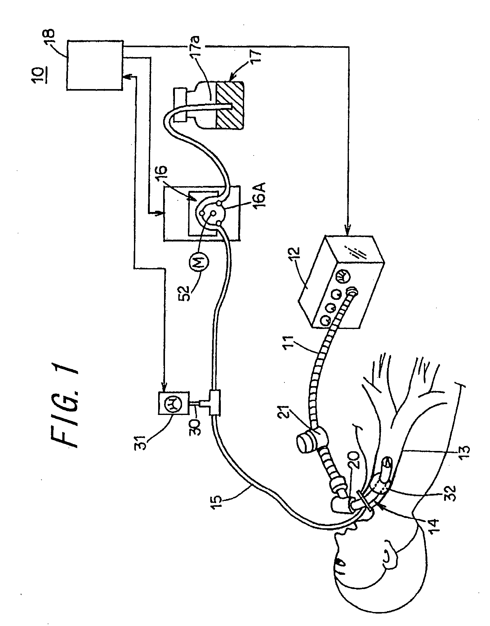 Tracheal Cannula