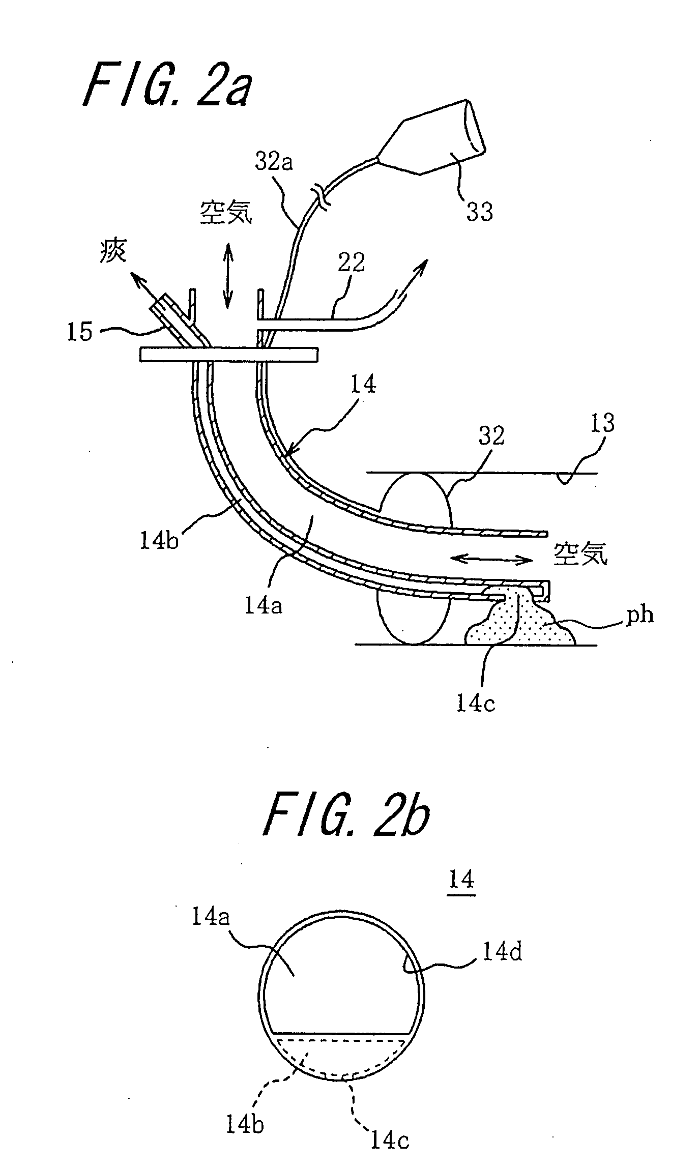 Tracheal Cannula