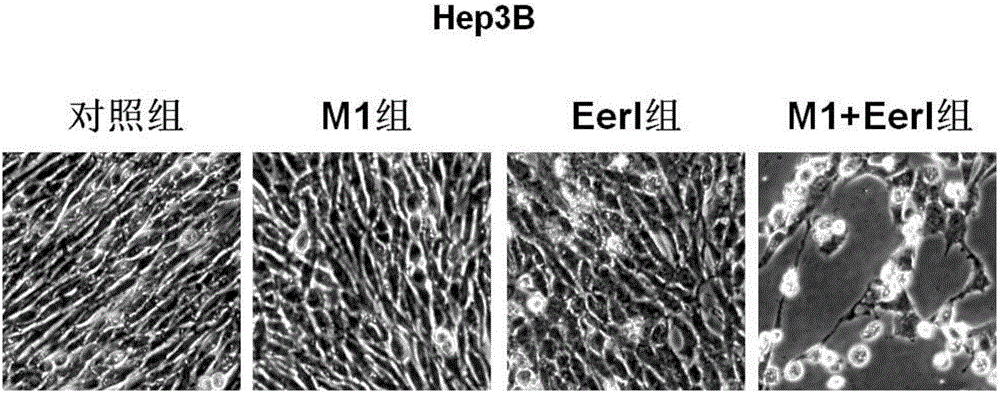 Application of VCP (valosin containing protein) inhibitor and oncolytic virus in preparation of antitumor drugs