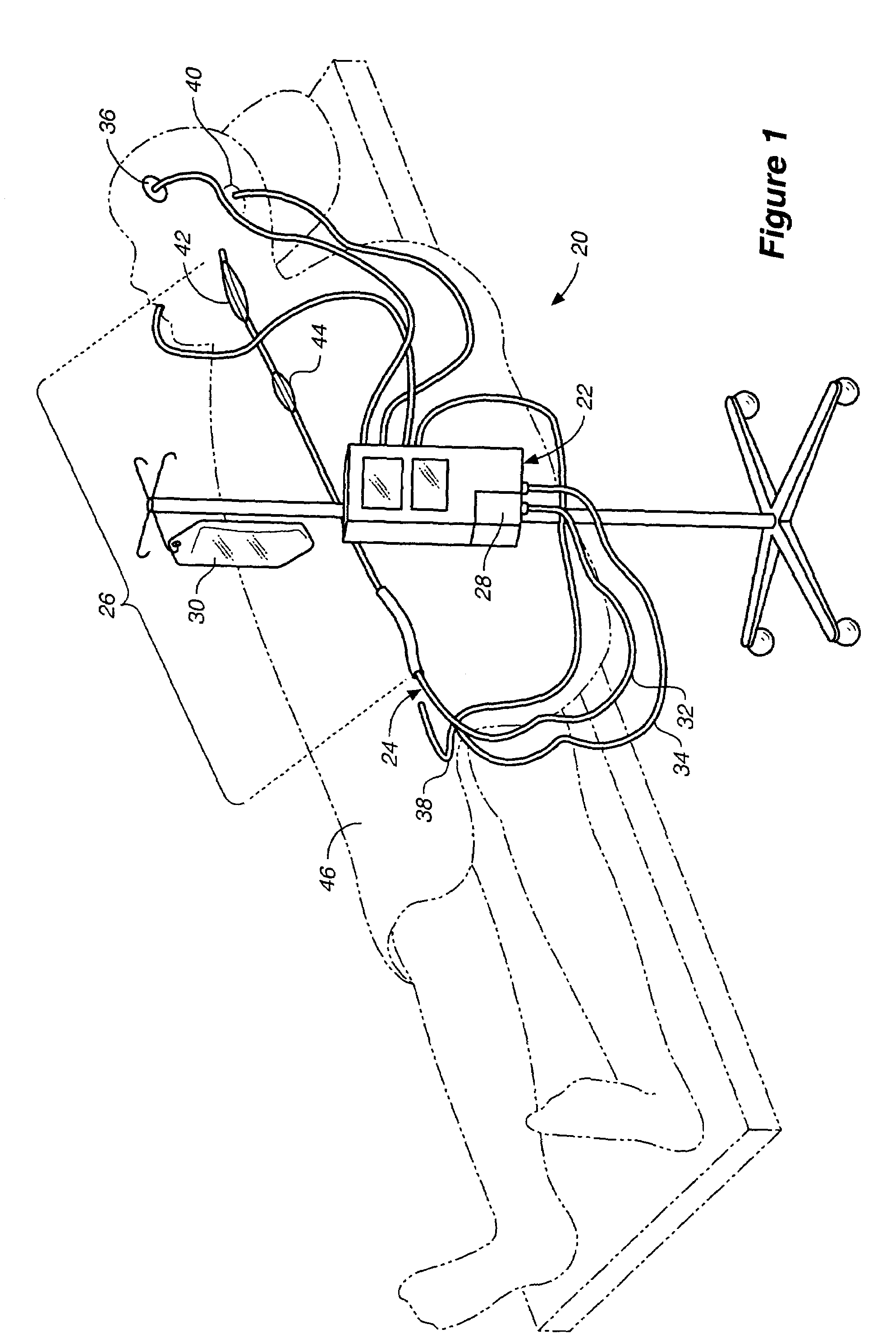 Method and system for control of a patient's body temperature by way of transluminally insertable heat exchange catheter