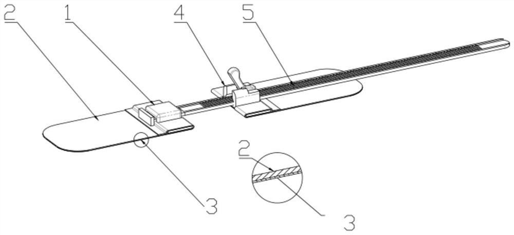 Flexible skin distraction closer